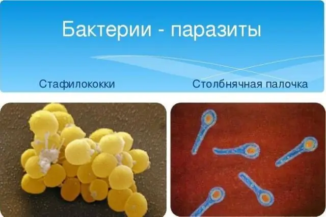 Өсімдік споралары мен бактерия споралары қалай ерекшеленеді?